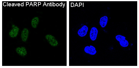 Cleaved PARP Rabbit mAb