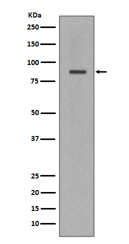 Cleaved PARP Rabbit mAb