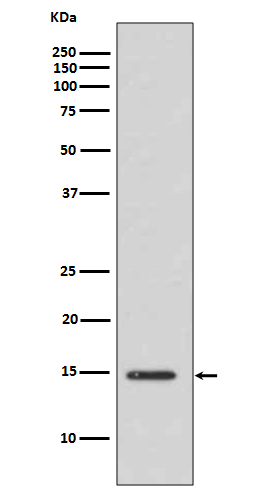 Histone H3 (acetyl K14) Rabbit mAb