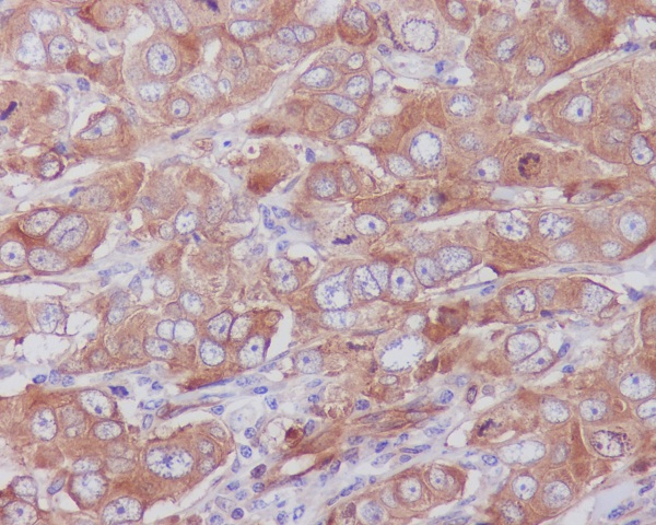 Paxillin Rabbit mAb