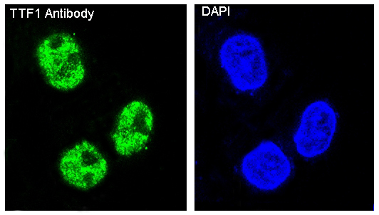 TTF1 Rabbit mAb