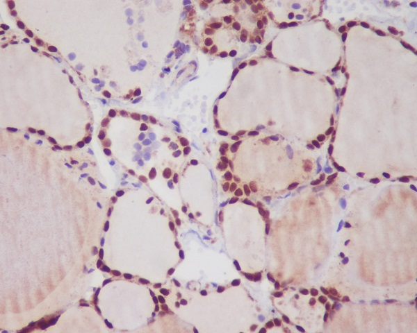 TTF1 Rabbit mAb