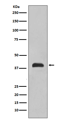 TTF1 Rabbit mAb