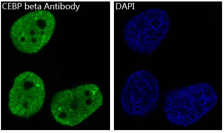 CEBP beta Rabbit mAb