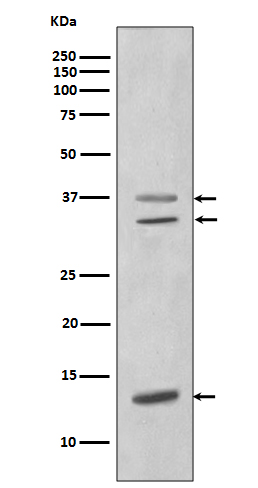 CEBP beta Rabbit mAb