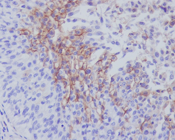 Thrombomodulin Rabbit mAb