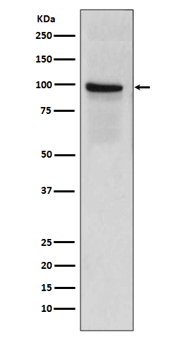 Thrombomodulin Rabbit mAb