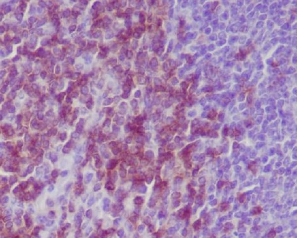 CD3 epsilon Rabbit mAb