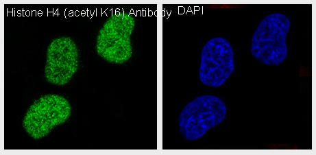 Histone H4 (acetyl K16) Rabbit mAb