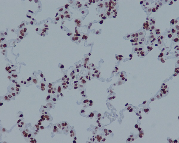 Histone H4 (acetyl K16) Rabbit mAb