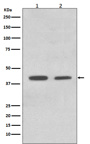 ACADM Rabbit mAb