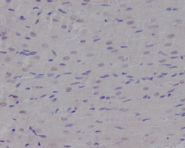 p95/NBS1 Rabbit mAb