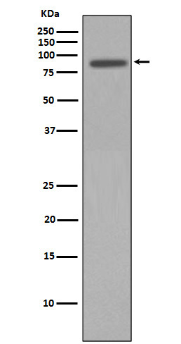 p95/NBS1 Rabbit mAb