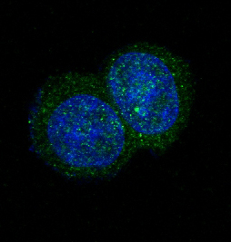 JAK2 Rabbit mAb