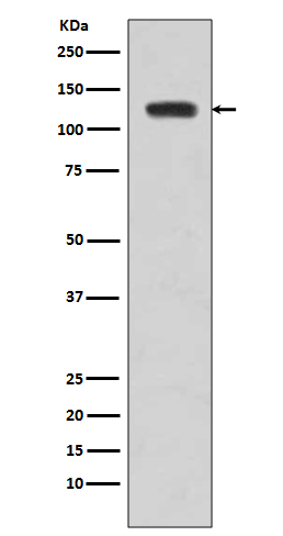 JAK2 Rabbit mAb