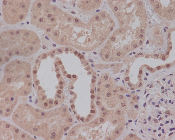 Smad1 Rabbit mAb