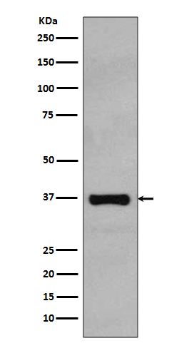 Rad51 Rabbit mAb