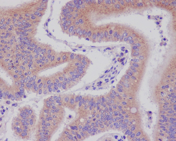 DNAJC15 Rabbit mAb