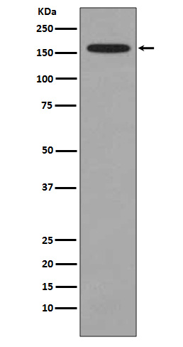 KMT4 / Dot1L Rabbit mAb 