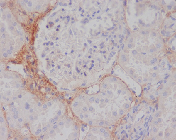 TGFBI Rabbit mAb