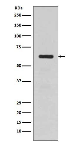 TGFBI Rabbit mAb