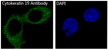 Cytokeratin 19 Rabbit mAb 