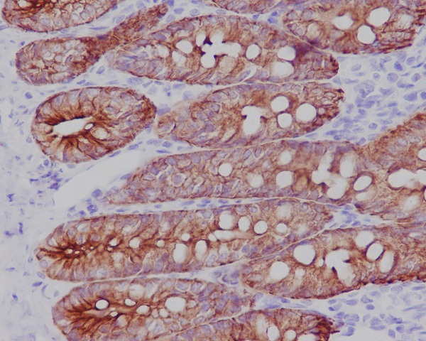 Cytokeratin 19 Rabbit mAb 