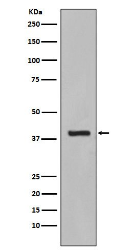 Cytokeratin 19 Rabbit mAb 