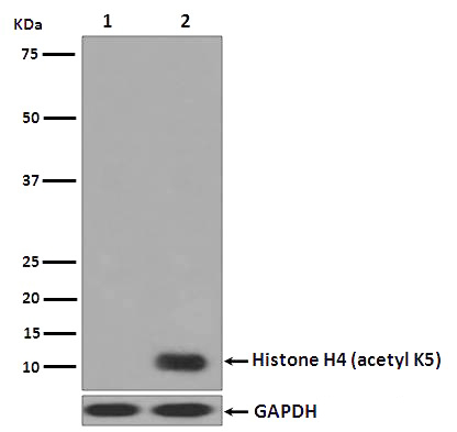 Histone H4 (acetyl K5) Rabbit mAb