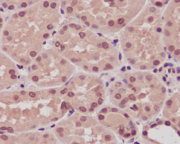 ARRB1 Rabbit mAb