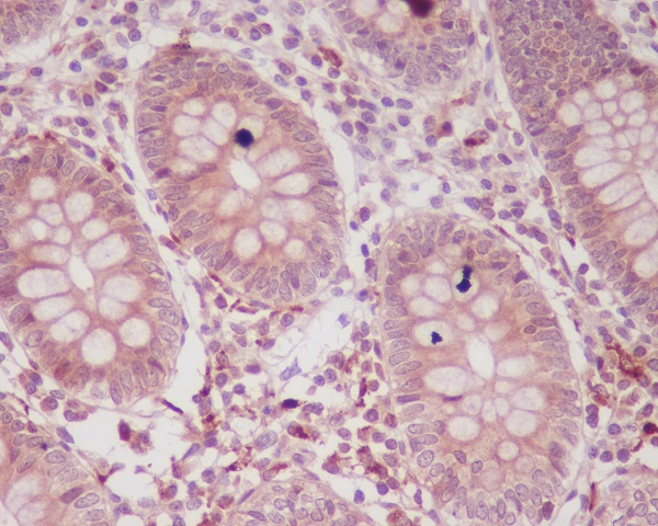 p16 ARC Rabbit mAb