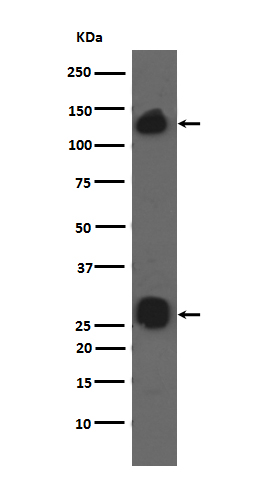 Integrin alpha V Rabbit mAb