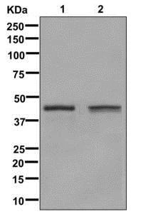 Glutamine Synthetase Rabbit mAb  