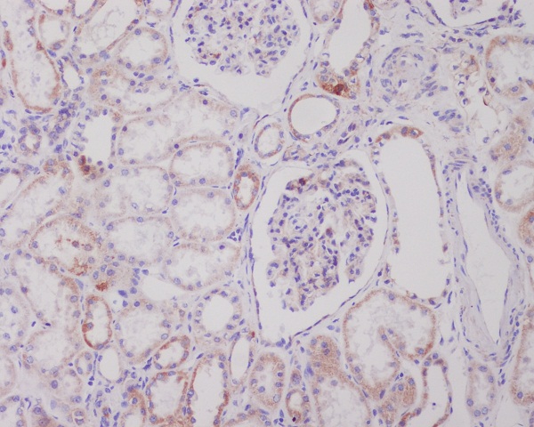 PI 3 Kinase Class 3 Rabbit mAb