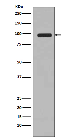 PI 3 Kinase Class 3 Rabbit mAb