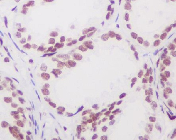 Androgen Receptor Rabbit mAb