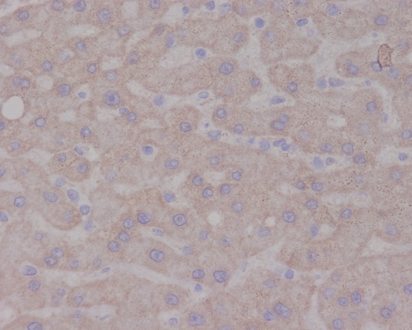 TrkA Rabbit mAb