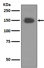 TrkA Rabbit mAb