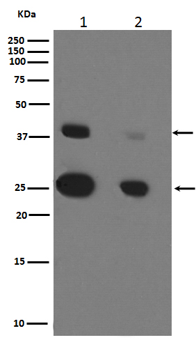 Cathepsin D Rabbit Mab - Sab 