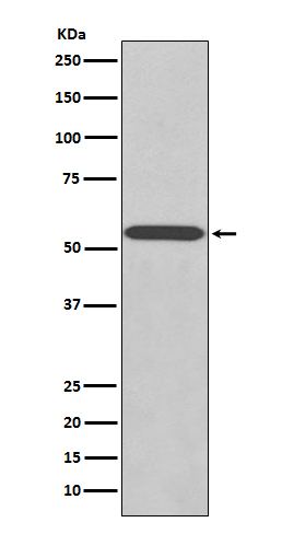 Wilms Tumor Protein Rabbit mAb