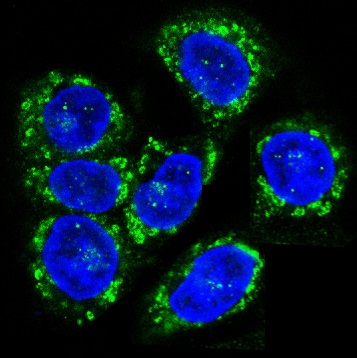 CCR7 Rabbit mAb