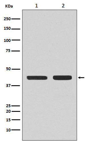 CCR7 Rabbit mAb