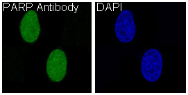 PARP Rabbit mAb