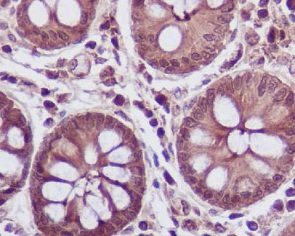 Lactate Dehydrogenase Rabbit mAb