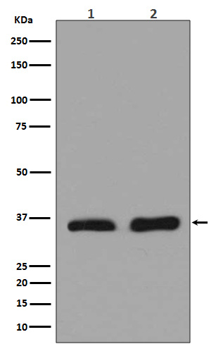 Lactate Dehydrogenase Rabbit mAb