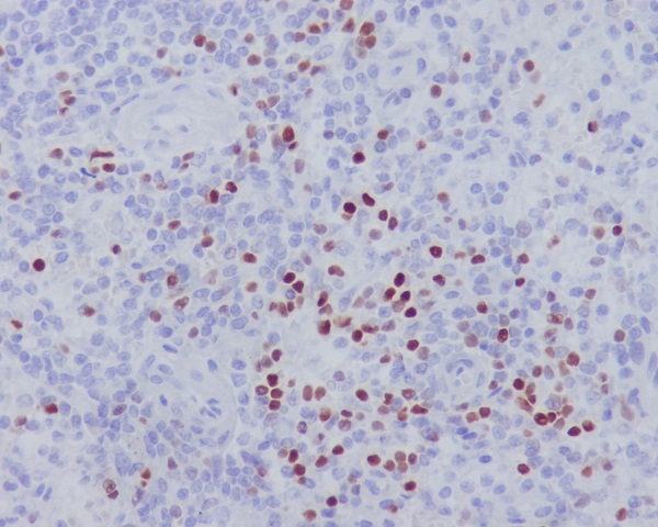 LEF1 Rabbit mAb