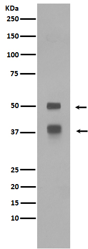 LEF1 Rabbit mAb