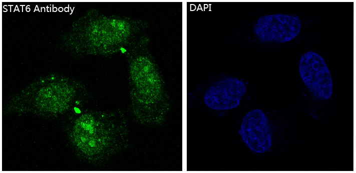 STAT6 Rabbit mAb