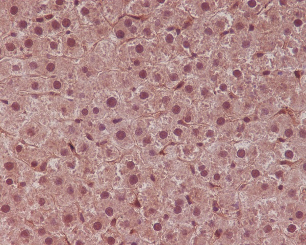 STAT6 Rabbit mAb