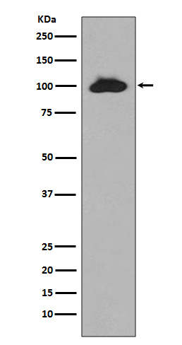 STAT6 Rabbit mAb